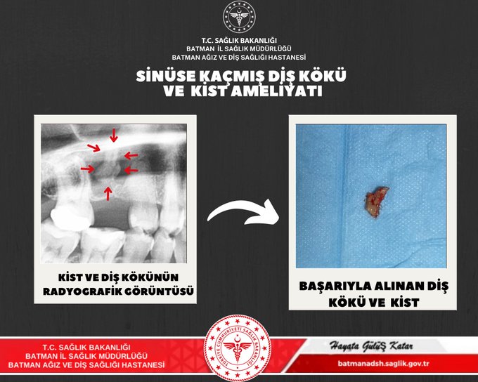 Ağız ve Diş Sağlığı Hastanesi’nden başarılı cerrahi müdahale