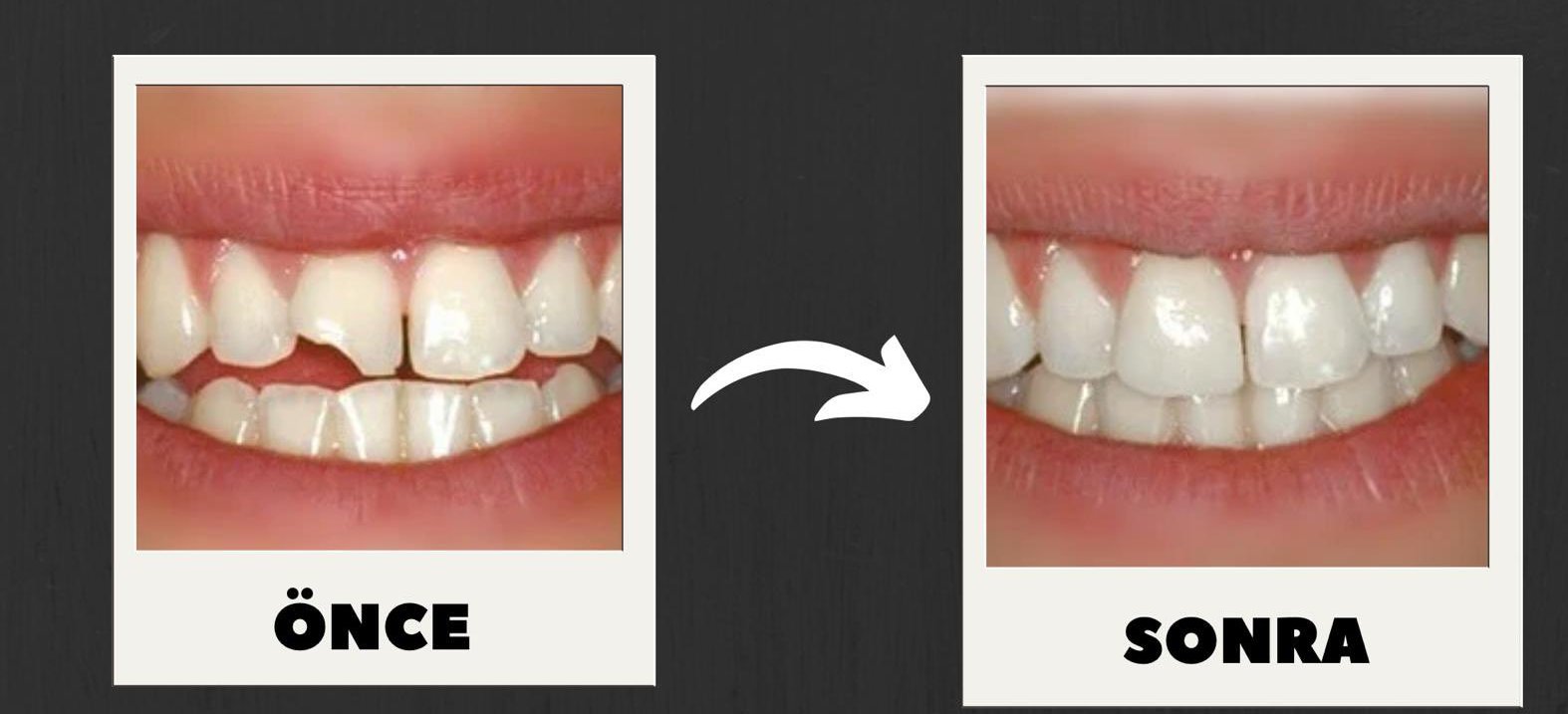 Ağız ve Diş Sağlığı Hastanesi’nden estetik ve fonksiyonel çözüm