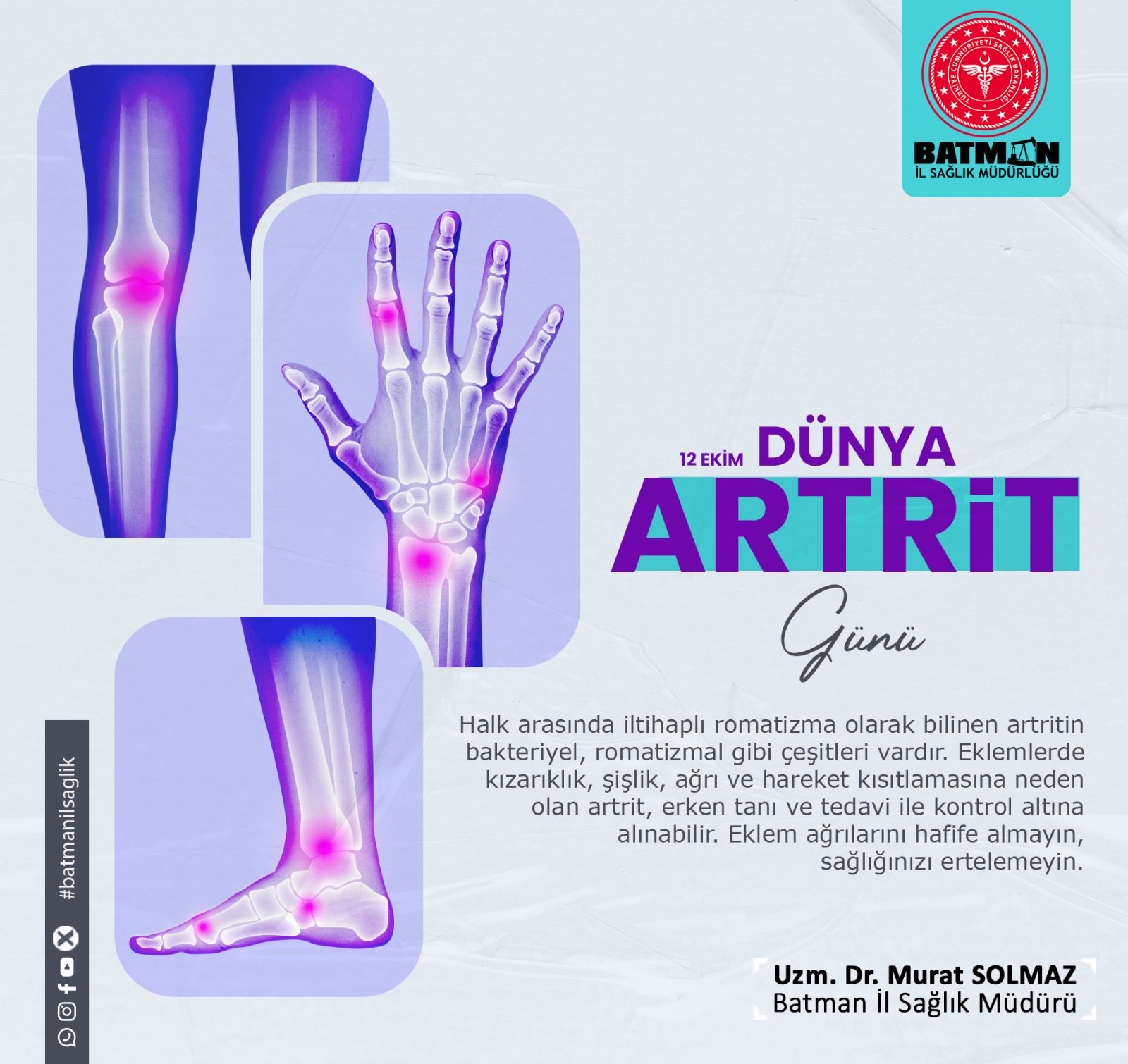 Artrit Hastalığında Erken Tanının Önemine Dikkat Çekti