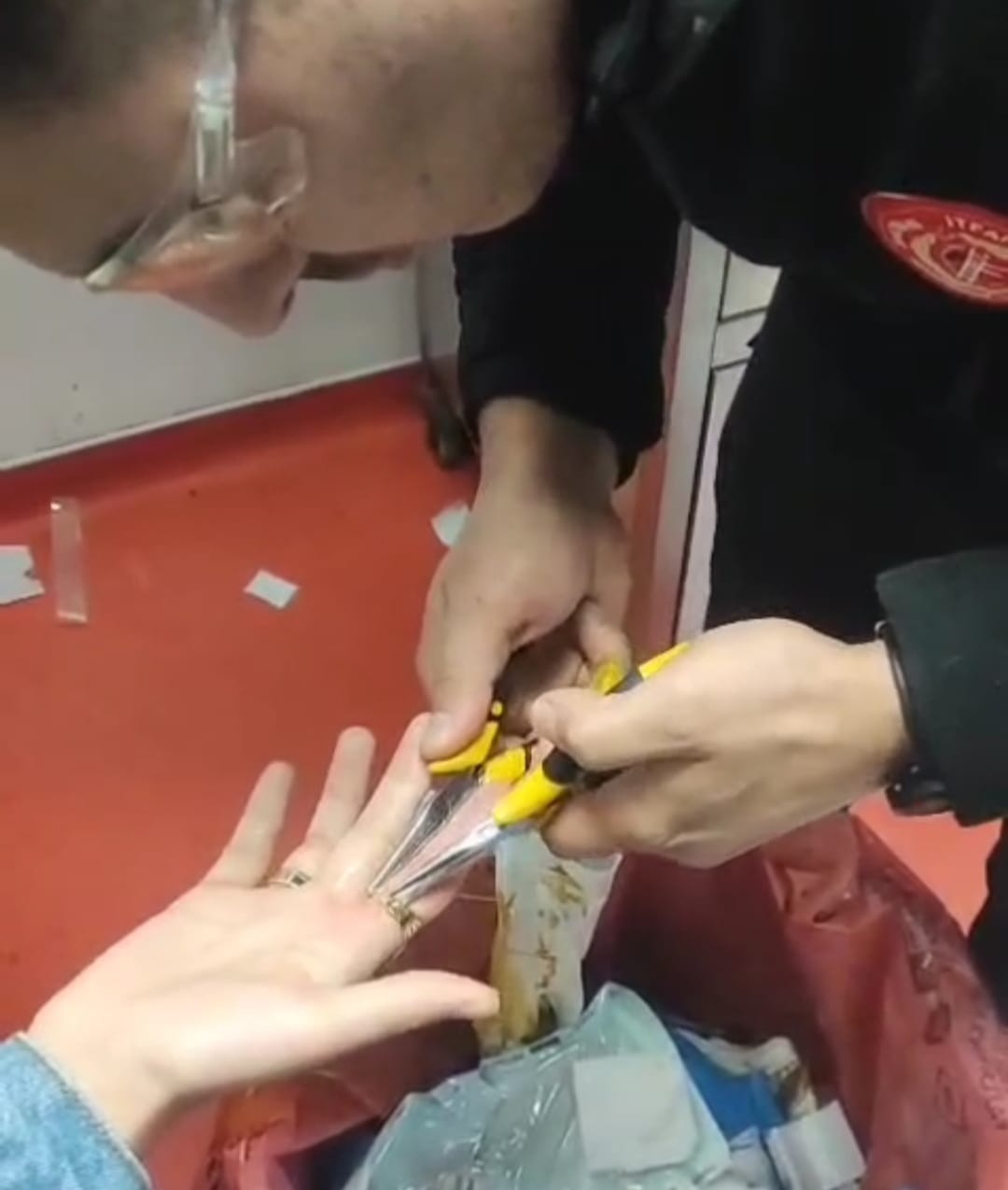 Yüzüğü Parmağından Çıkaramadı, İtfaiye Yetişti!