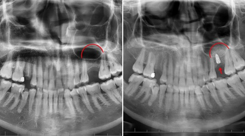 Batman’da Ağız ve Diş Sağlığı Hastanesi’nde Başarılı Ameliyat