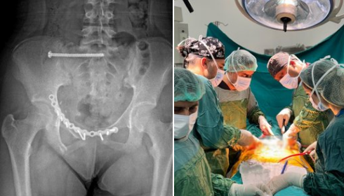 Batman’da Zorlu Ortopedik Ameliyat Başarıyla Tamamlandı